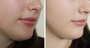 11 Mẹo Làm Đẹp Da Tại Nhà Tuy Đơn Giản Mà Hiệu Quả