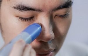 [Giải đáp] Có nên dùng máy hút mụn không?