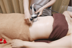 Hút mỡ bằng Laser Smart lipo là gì?