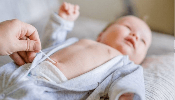 Rốn trẻ sơ sinh cần được vệ sinh sạch sẽ mỗi ngày