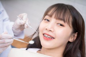 Top 5 Nha khoa niềng răng uy tín tại Sài Gòn